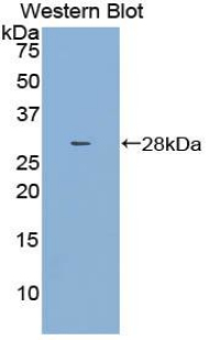 Polyclonal Antibody to Dihydropyrimidinase Like Protein 3 (DPYSL3)