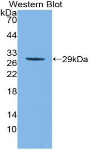 Polyclonal Antibody to Myeloid Cell Nuclear Differentiation Antigen (MNDA)