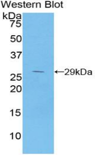 Polyclonal Antibody to Inhibitory Subunit Of NF Kappa B Beta (IkBb)