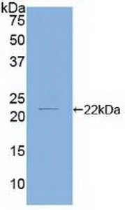 Polyclonal Antibody to Cofilin 2, Muscle (CFL2)