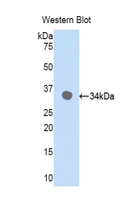 Polyclonal Antibody to Cyclin Dependent Kinase 7 (CDK7)