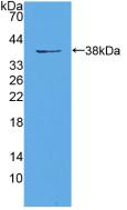 Polyclonal Antibody to Eukaryotic Translation Initiation Factor 3A (EIF3A)