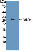 Polyclonal Antibody to Sperm Protein 17 (Sp17)
