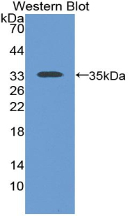 Polyclonal Antibody to Sodium Hydrogen Exchange Regulatory Cofactor 2 (SLC9A3R2)