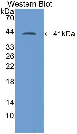 Polyclonal Antibody to Sodium Hydrogen Exchange Regulatory Cofactor 2 (SLC9A3R2)