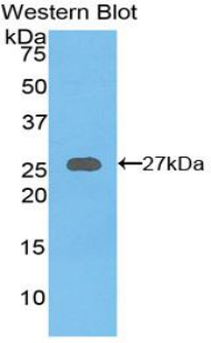 Polyclonal Antibody to Axis Inhibition Protein (AXIN)