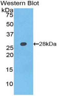 Polyclonal Antibody to Axis Inhibition Protein (AXIN)