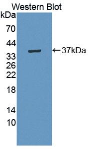 Polyclonal Antibody to Erythrocyte Membrane Protein Band 4.1 (EPB41)