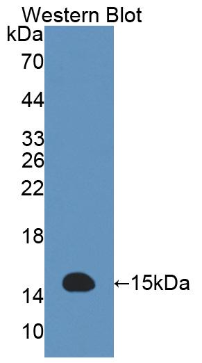 Polyclonal Antibody to Acylphosphatase 2 (ACYP2)