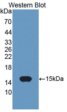 Polyclonal Antibody to Acylphosphatase 2 (ACYP2)