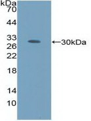 Polyclonal Antibody to Autocrine Motility Factor Receptor (AMFR)