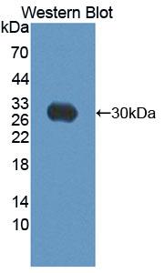 Polyclonal Antibody to Autocrine Motility Factor Receptor (AMFR)