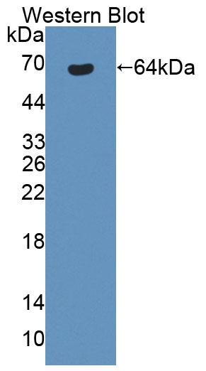 Polyclonal Antibody to Bestrophin 1 (BEST1)