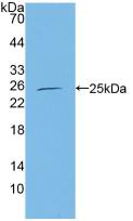Polyclonal Antibody to Core Binding Factor Beta Subunit (CBFb)