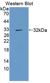 Polyclonal Antibody to Fucose-1-Phosphate Guanylyltransferase (FPGT)