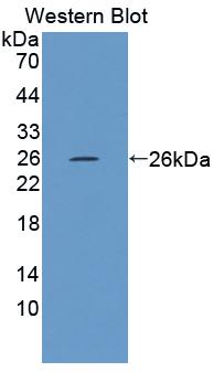 Polyclonal Antibody to Fucose-1-Phosphate Guanylyltransferase (FPGT)