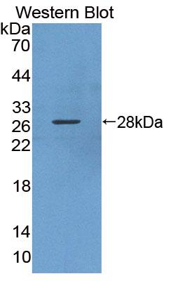 Polyclonal Antibody to Karyopherin Alpha 3 (KPNa3)