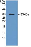 Polyclonal Antibody to Beta-ureidopropionase (UPB1)