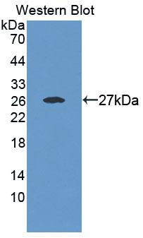 Polyclonal Antibody to YY1 Associated Factor 2 (YAF2)