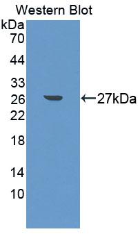 Polyclonal Antibody to YY1 Associated Factor 2 (YAF2)