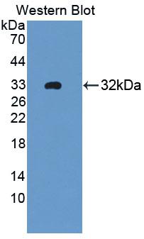 Polyclonal Antibody to Zinc Finger Protein 10 (ZNF10)