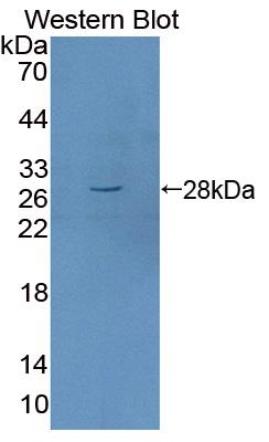 Polyclonal Antibody to Myelin Transcription Factor 1 (MYT1)