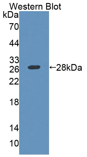 Polyclonal Antibody to Myelin Transcription Factor 1 (MYT1)