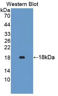 Polyclonal Antibody to Trafficking Protein Particle Complex 2 (TRAPPC2)