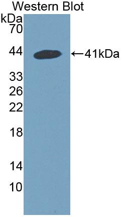 Polyclonal Antibody to Snurportin 1 (SNUPN1)
