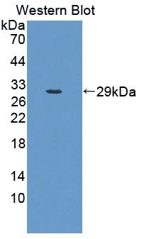 Polyclonal Antibody to Clathrin, Light Polypeptide A (CLTA)