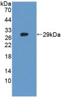 Polyclonal Antibody to Tankyrase 2 (TNKS2)