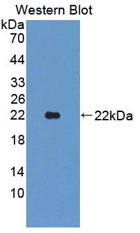 Polyclonal Antibody to Lipocalin 11 (LCN11)