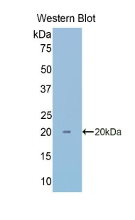 Polyclonal Antibody to Carbonic Anhydrase VII (CA7)