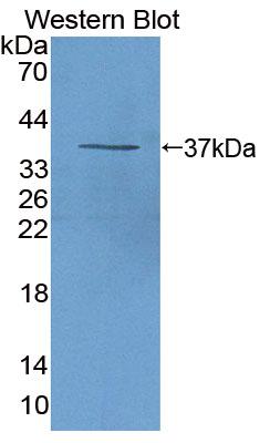 Polyclonal Antibody to Arachidonate-12-Lipoxygenase, 12R Type (ALOX12B)