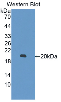 Polyclonal Antibody to Myosin Light Chain 6, Alkali, Smooth Muscle And Non Muscle (MYL6)