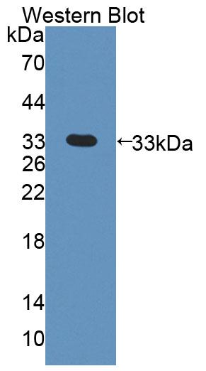 Polyclonal Antibody to Pyruvate Dehydrogenase Kinase Isozyme 3 (PDK3)