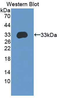 Polyclonal Antibody to Amyloid Beta Precursor Protein Binding Protein A3 (APBA3)