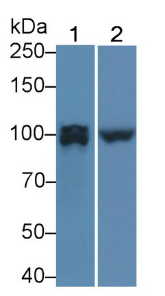 Polyclonal Antibody to Protein Tyrosine Phosphatase Receptor Type U (PTPRU)