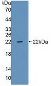 Polyclonal Antibody to Protein Tyrosine Phosphatase Receptor Type Z (PTPRZ)