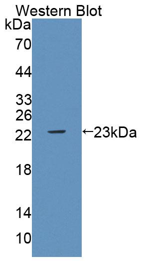 Polyclonal Antibody to Protein Tyrosine Phosphatase Type IVA 2 (PTP4A2)