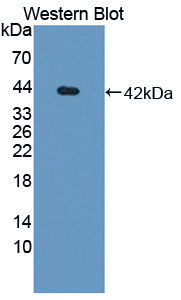 Polyclonal Antibody to Killer Cell Immunoglobulin Like Receptor 2DL5 (KIR2DL5)