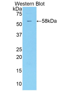 Polyclonal Antibody to Killer Cell Immunoglobulin Like Receptor 2DS2 (KIR2DS2)