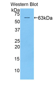 Polyclonal Antibody to Killer Cell Immunoglobulin Like Receptor 2DL2 (KIR2DL2)