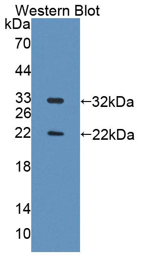 Polyclonal Antibody to Topoisomerase II Binding Protein 1 (TOPBP1)