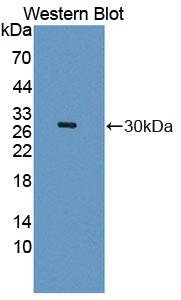 Polyclonal Antibody to Dipeptidyl Peptidase 3 (DPP3)