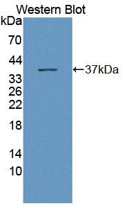 Polyclonal Antibody to 3',5'-Bisphosphate Nucleotidase 1 (BPNT1)