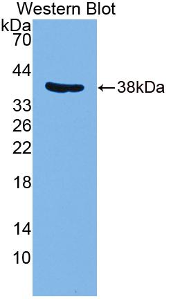 Polyclonal Antibody to Protein Phosphatase 6, Catalytic Subunit (PPP6C)