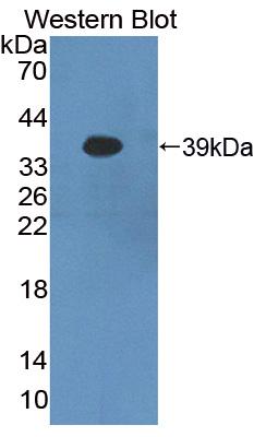 Polyclonal Antibody to Protocadherin Beta 16 (PCDHb16)