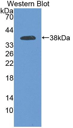 Polyclonal Antibody to Protocadherin Beta 15 (PCDHb15)