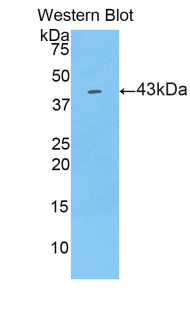 Polyclonal Antibody to Lipocalin 9 (LCN9)